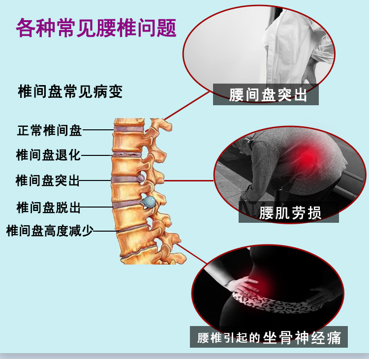 百傲鲨加宽轻薄护腰